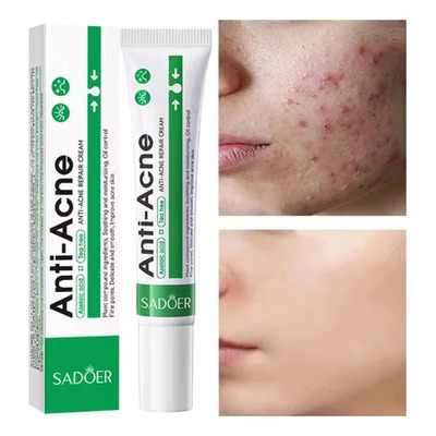 جل مضاض للحبوب SADOER