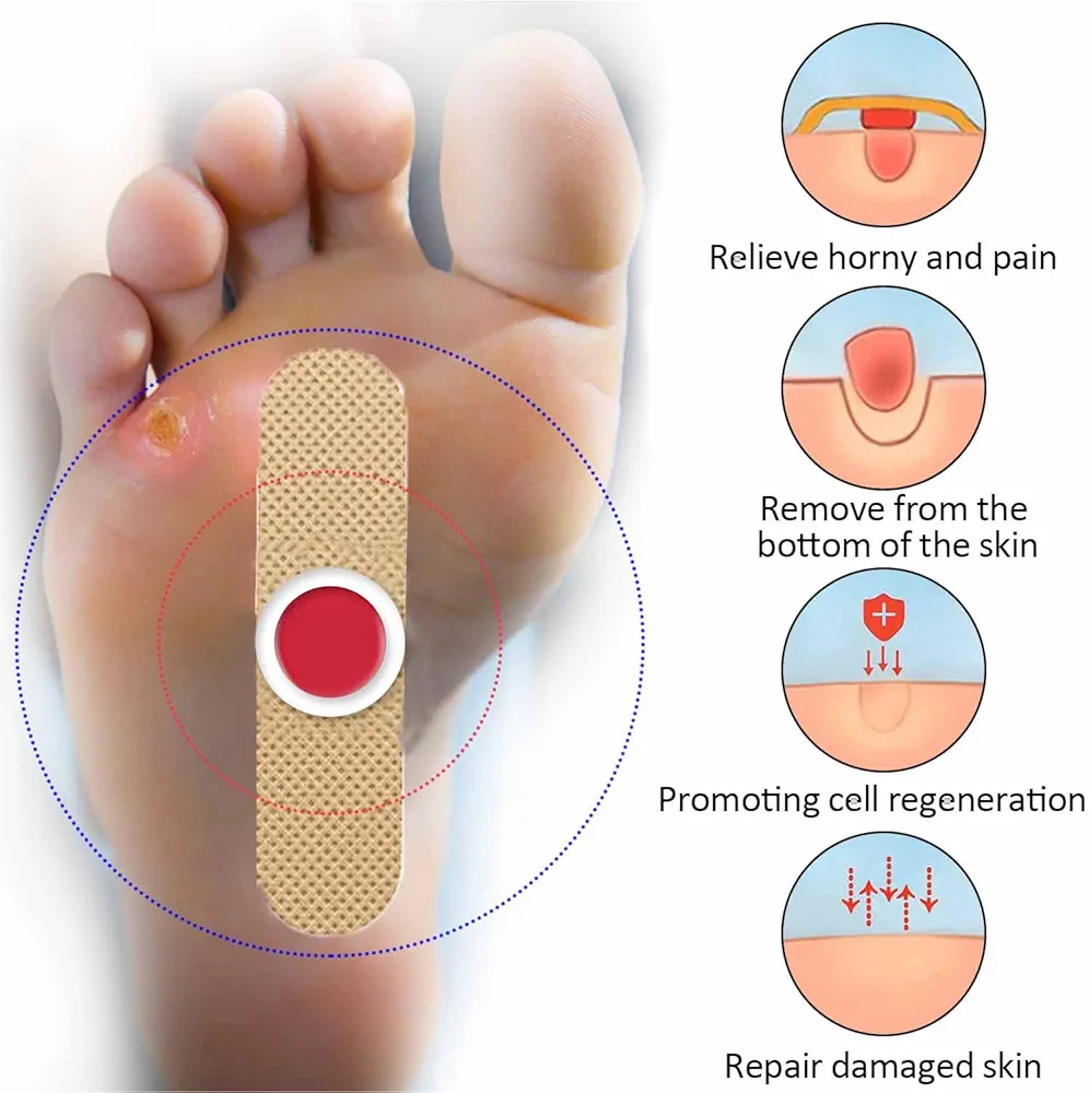 لاصقات مسمار الحم